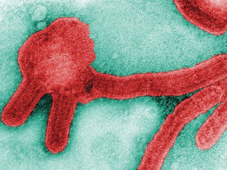 Qu&rsquo;est-ce que le virus de Marburg fait peur à l&rsquo;Afrique