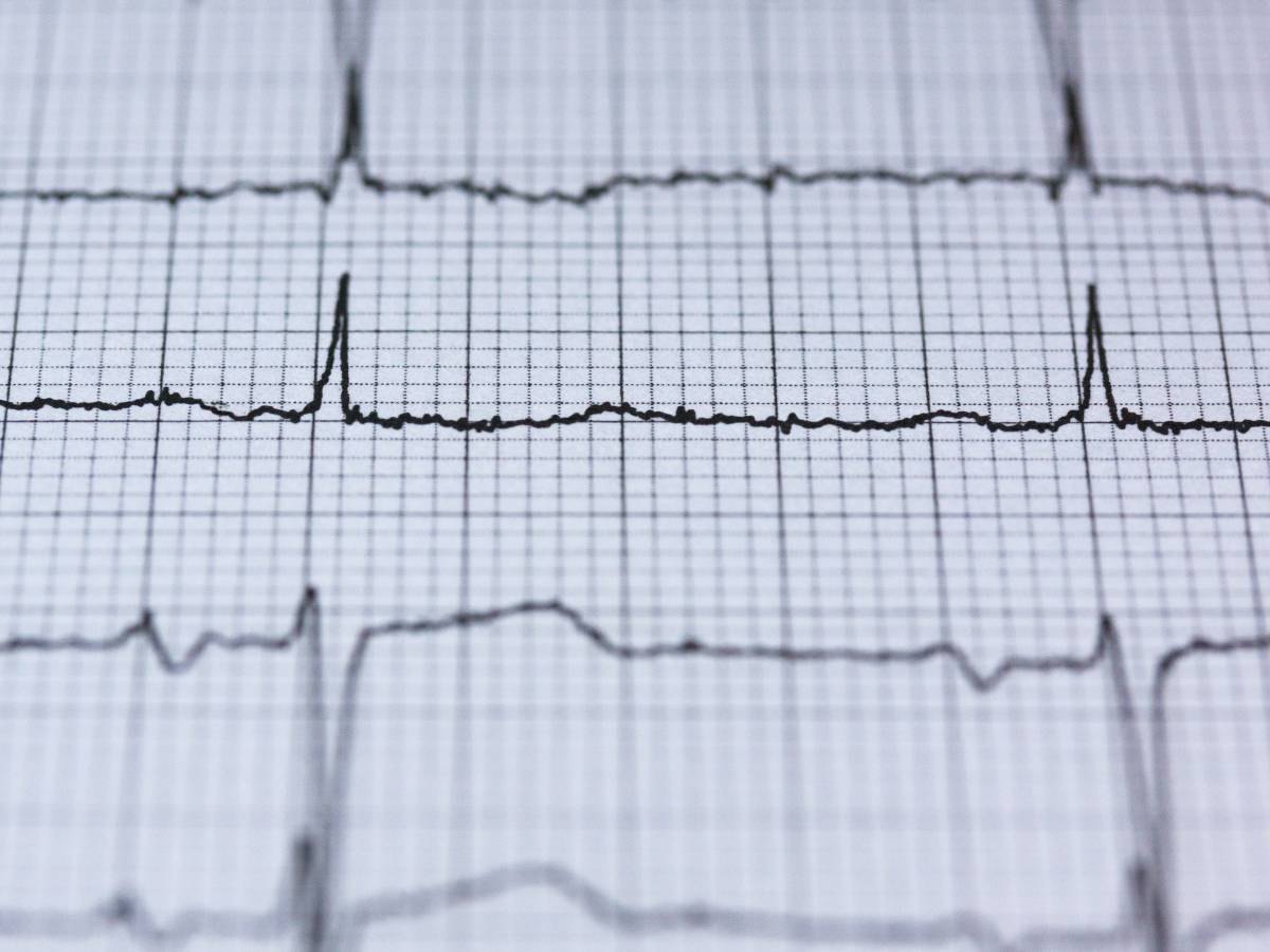 crise cardiaque
