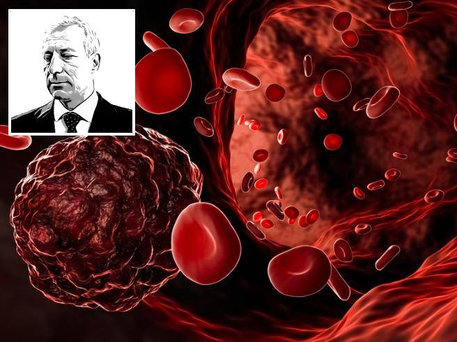 Lymphome médiastinal primitif traité par CAR-T, quel est le risque de récidive de la tumeur ?