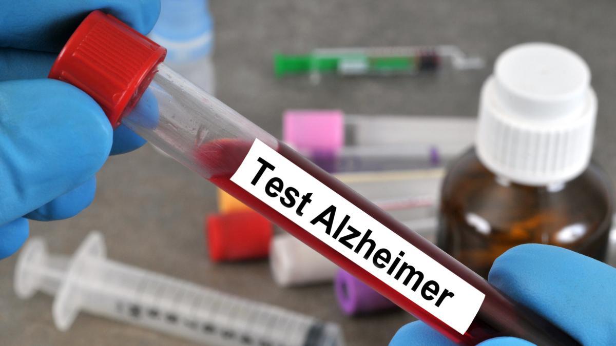 Alzheimer, un nouveau test sanguin diagnostique la maladie avec une ...