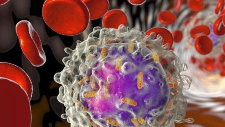 Leucémie lymphoïde chronique et lymphome du manteau : l’ajout d’un nouveau médicament réduit le risque d’évolution de la maladie