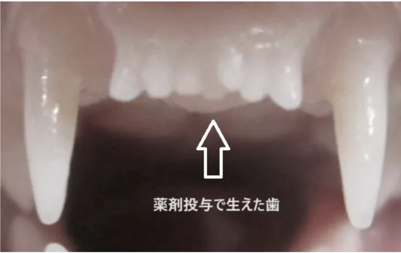 dents repoussées