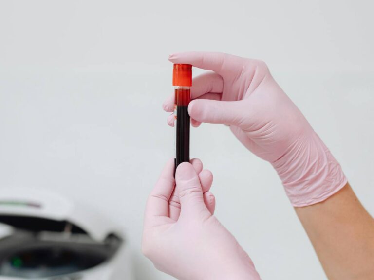 Potassium élevé dans le sang: attention à ces symptômes