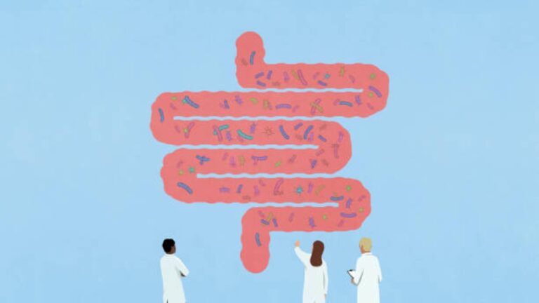 Intestin irritable? Voici quoi faire