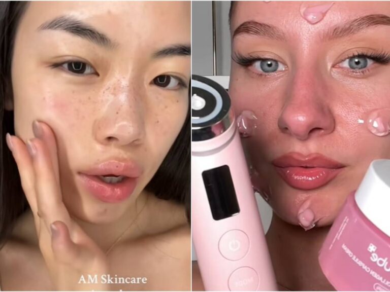 Dermogexie, l'Est L'obsession ici désopule sur les Réseaux sociaux