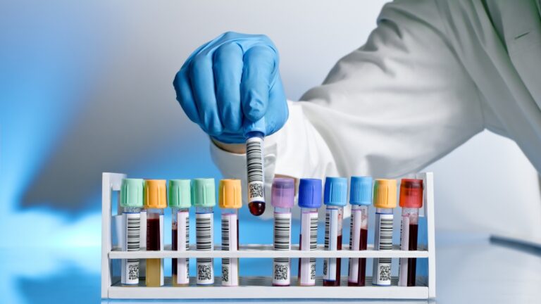 Greffe de moelle osseuse : comment reconnaître le « rejet » (qui survient dans la moitié des cas) et comment le traiter aujourd&rsquo;hui