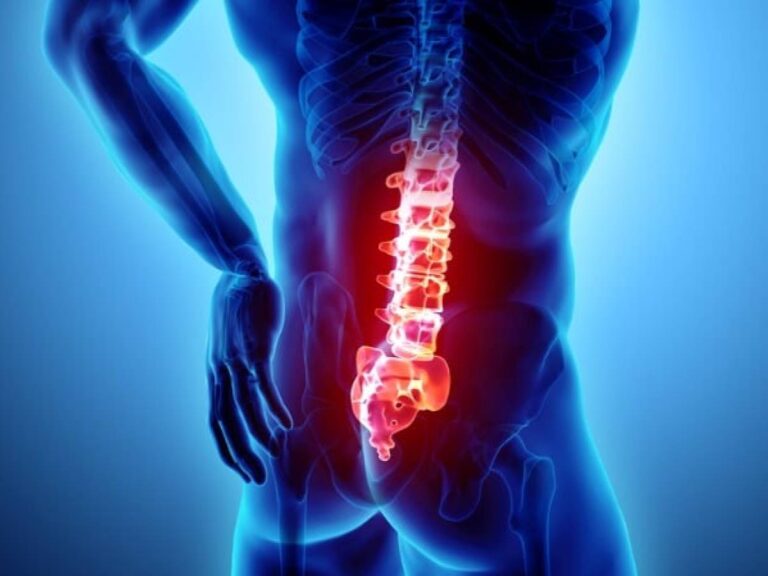 Lombalgie, quelles sont les causes et les traitements ?