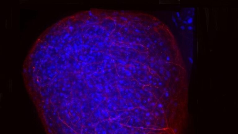 Sclérose en plaques, un « vieux » médicament peut protéger et réparer le tissu nerveux