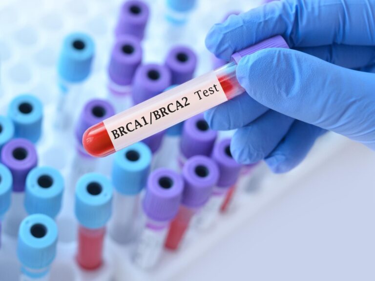 Cancer du pancréas métastatique, un nouveau médicament réduit le risque de progression de la maladie : également disponible en Italie