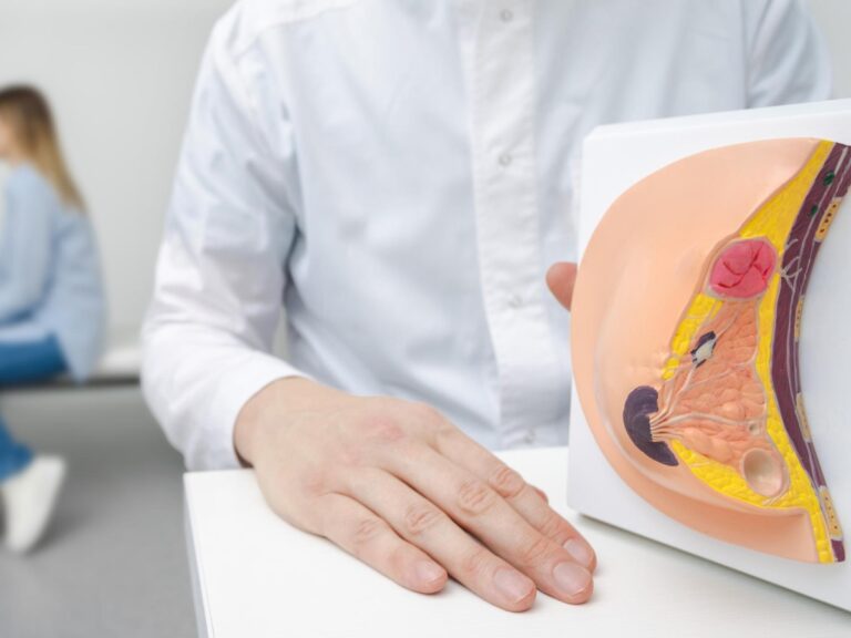 Cancer du sein à un stade précoce, un nouveau médicament réduit le risque de récidive et de métastases (possible même après 20 ans)