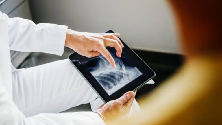 Lésions de la moelle épinière : récupération de la force et de la sensibilité musculaire possible même chez les personnes âgées