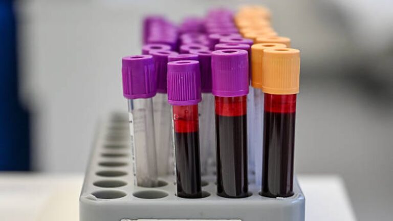 Une technologie transfusionnelle peut-elle se transformer en vaccin contre le cancer ?