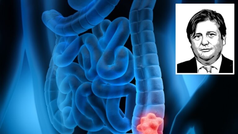 Cancer du côlon en hausse : comment ceux qui ont des membres de leur famille atteints de la maladie doivent-ils se protéger ?