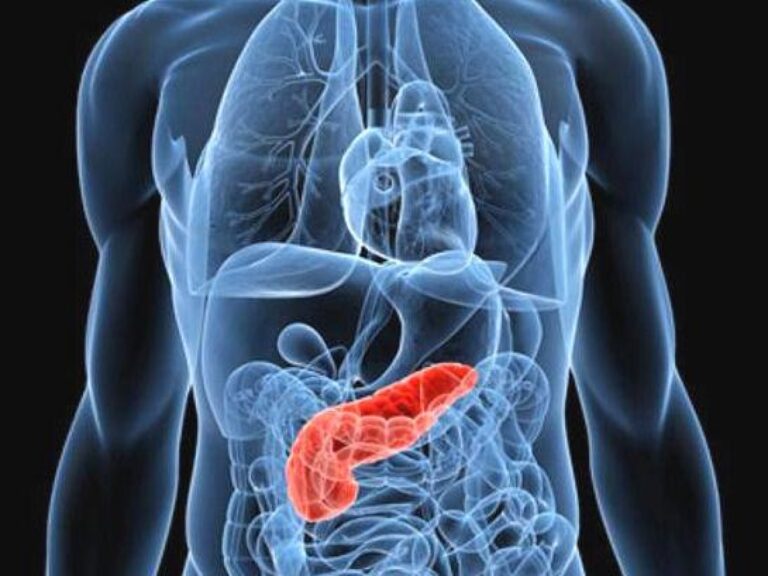 Cancer du pancréas, de nouvelles recherches pour améliorer la quantité et la qualité de vie des personnes malades