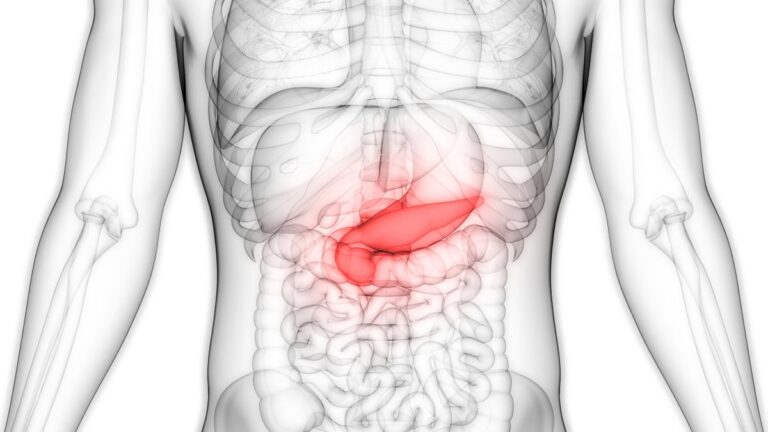 Cancer du pancréas, la « colle radioactive » qui cible le cœur de la maladie