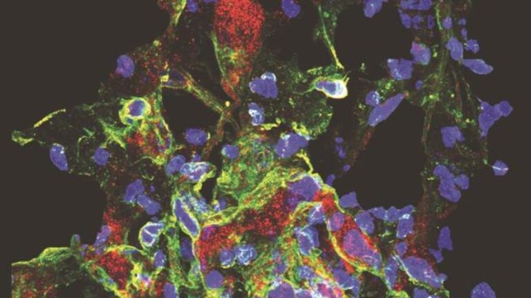 Des neurones « imprimés » qui communiquent avec les cellules cérébrales vivantes