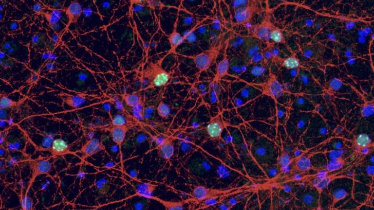 Syndrome de Rett : une étude italienne indique de nouvelles pistes pour la thérapie génique