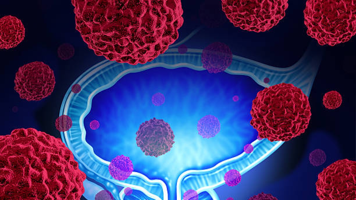 Sitemapcdatahttpdekokniqoocomronit Elkabetz Quel Cancer