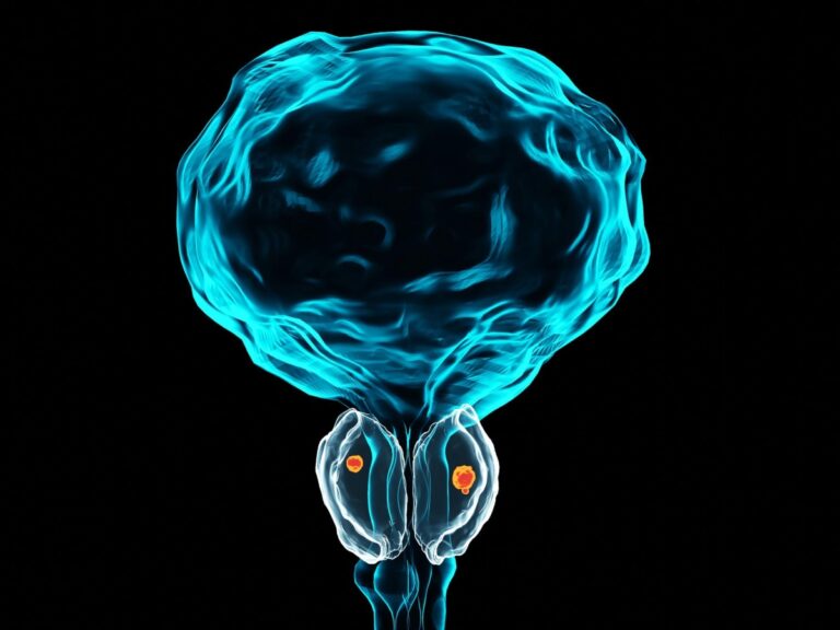 Cancer de la prostate métastatique, une solution supplémentaire (très bien tolérée) pour ralentir l&rsquo;avancée de la maladie