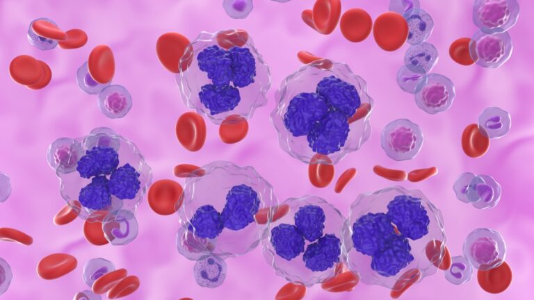 Vingt ans sans cancer : l&rsquo;histoire d&rsquo;un ancien patient illustre les progrès réalisés contre le lymphome folliculaire
