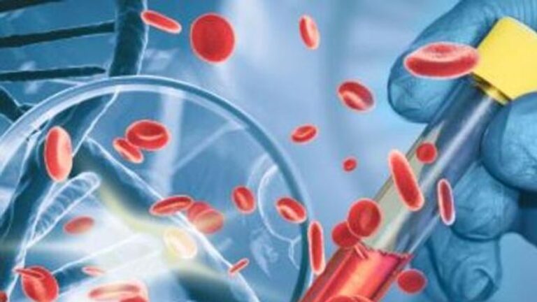 Cancers du sang : pour que tous les patients italiens puissent bénéficier des tests les plus précis et des meilleurs traitements au cas par cas