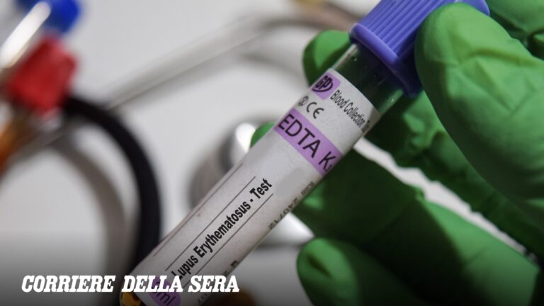 Lupus, le diagnostic arrive même après 6 ans. Le premier registre national visant à améliorer les traitements et la recherche est en cours