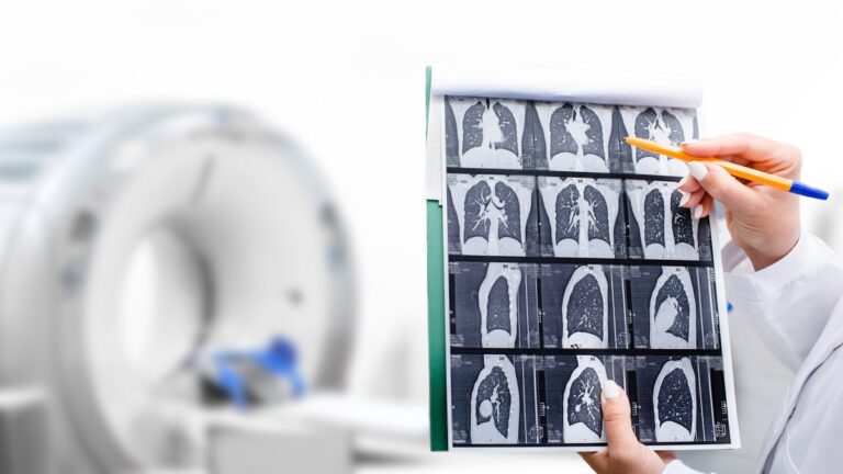 Poumon, car il est essentiel de connaître les mutations de la tumeur de chaque patient pour choisir la meilleure thérapie