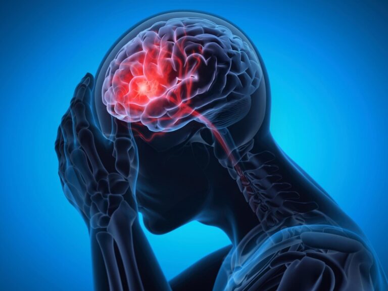 Accident vasculaire cérébral, les cas augmentent dans la tranche d&rsquo;âge de 20 à 54 ans : hypertension, diabète et toxicomanie parmi les causes