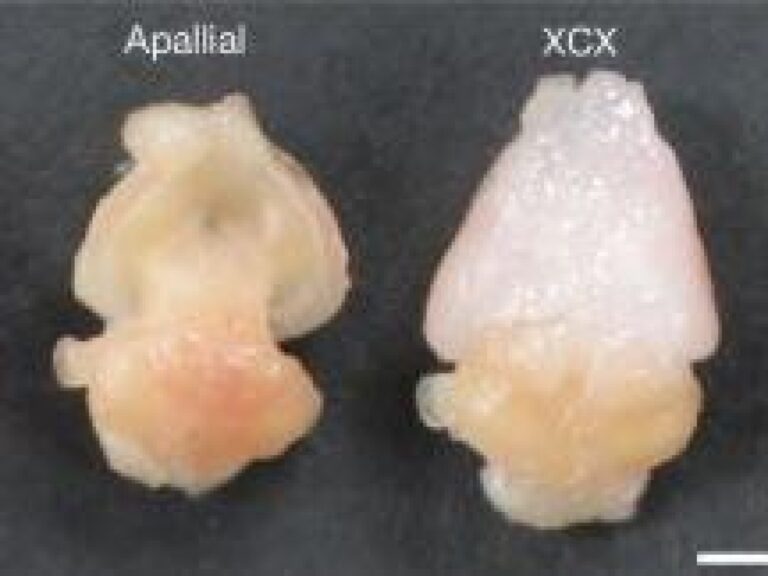 Des organoïdes cérébraux humains transplantés chez des souris modifiées (avec un demi-cerveau) produisent de nouveaux neurones