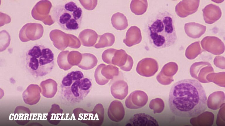 Leucémie aiguë lymphoblastique, nouvelles perspectives : taux de survie supérieurs à 80 % chez les patients adultes
