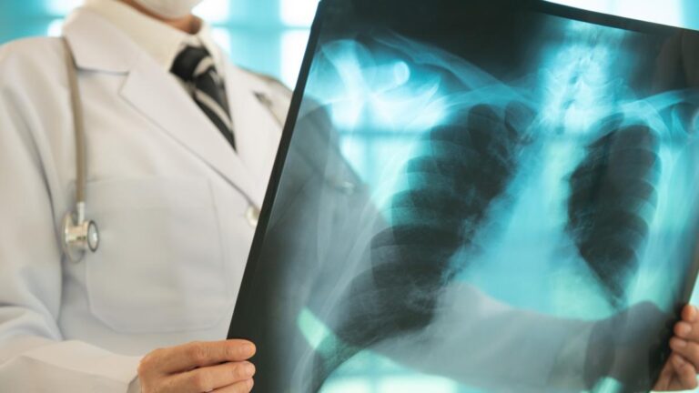 Cancer du poumon, la nouvelle la plus importante du congrès européen : deux études changent la façon de le traiter